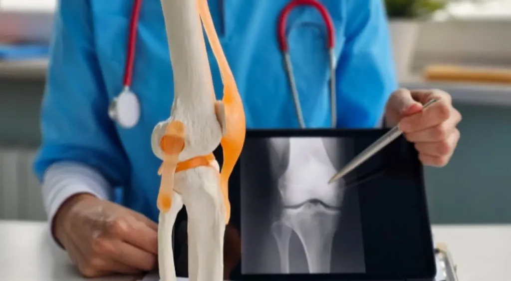 runners knee treatment